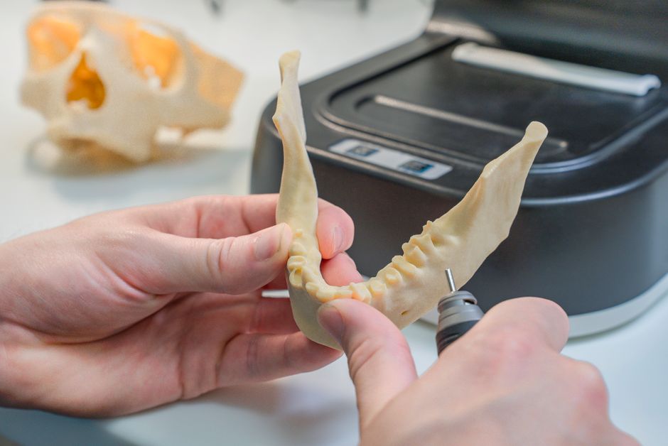 Patient resting after dental implant surgery while managing pain recovery