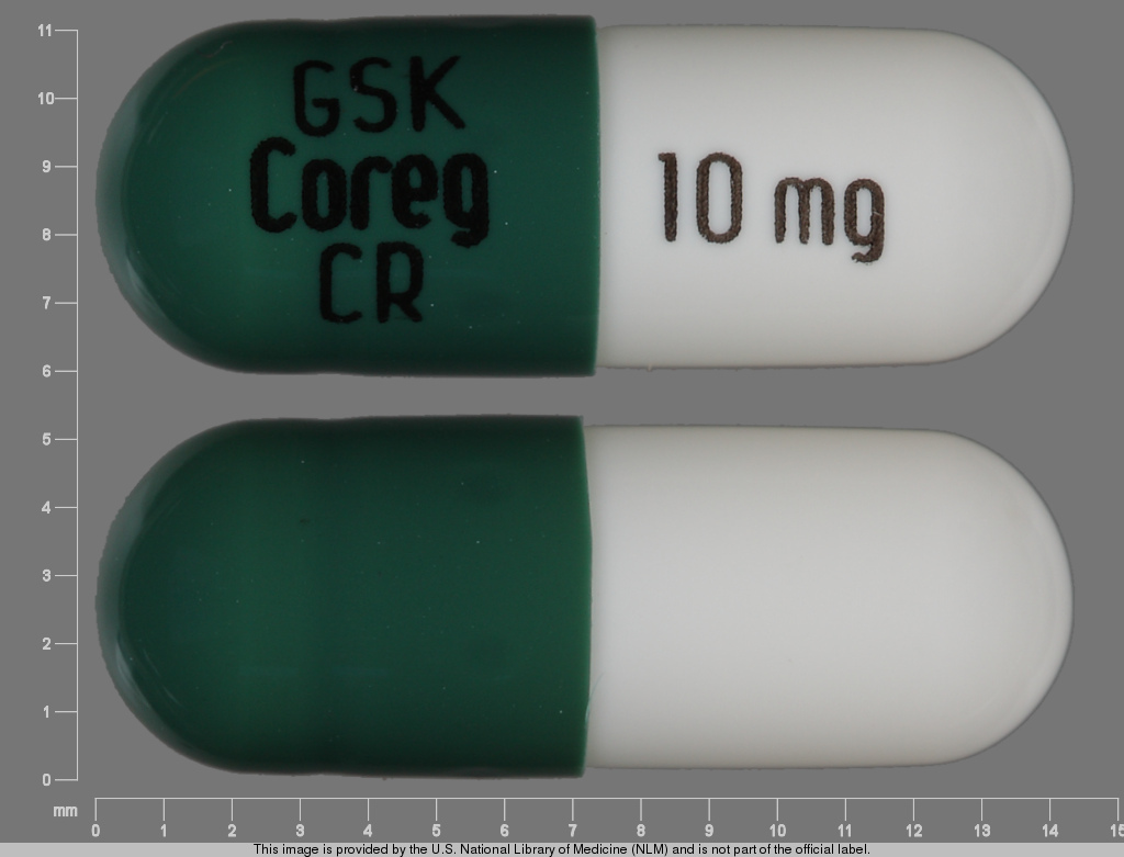 Photo of pill imprinted GSK