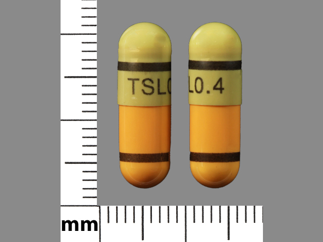 TSL