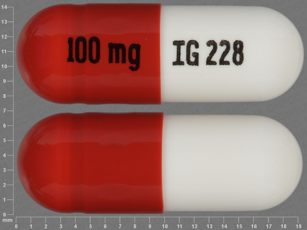 Photo of pill imprinted IG